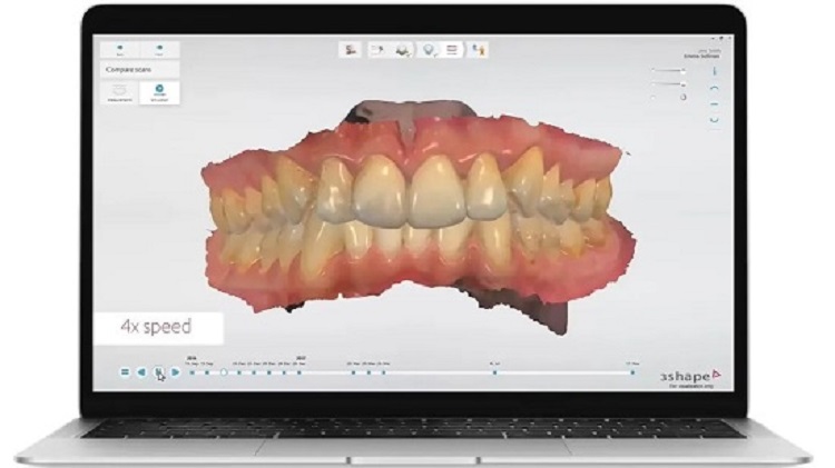 Фото 3D сканер 3Shape TRIOS 3 Cart 4